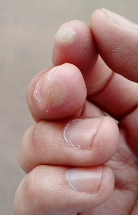 Don’t get these from playing clarinet.